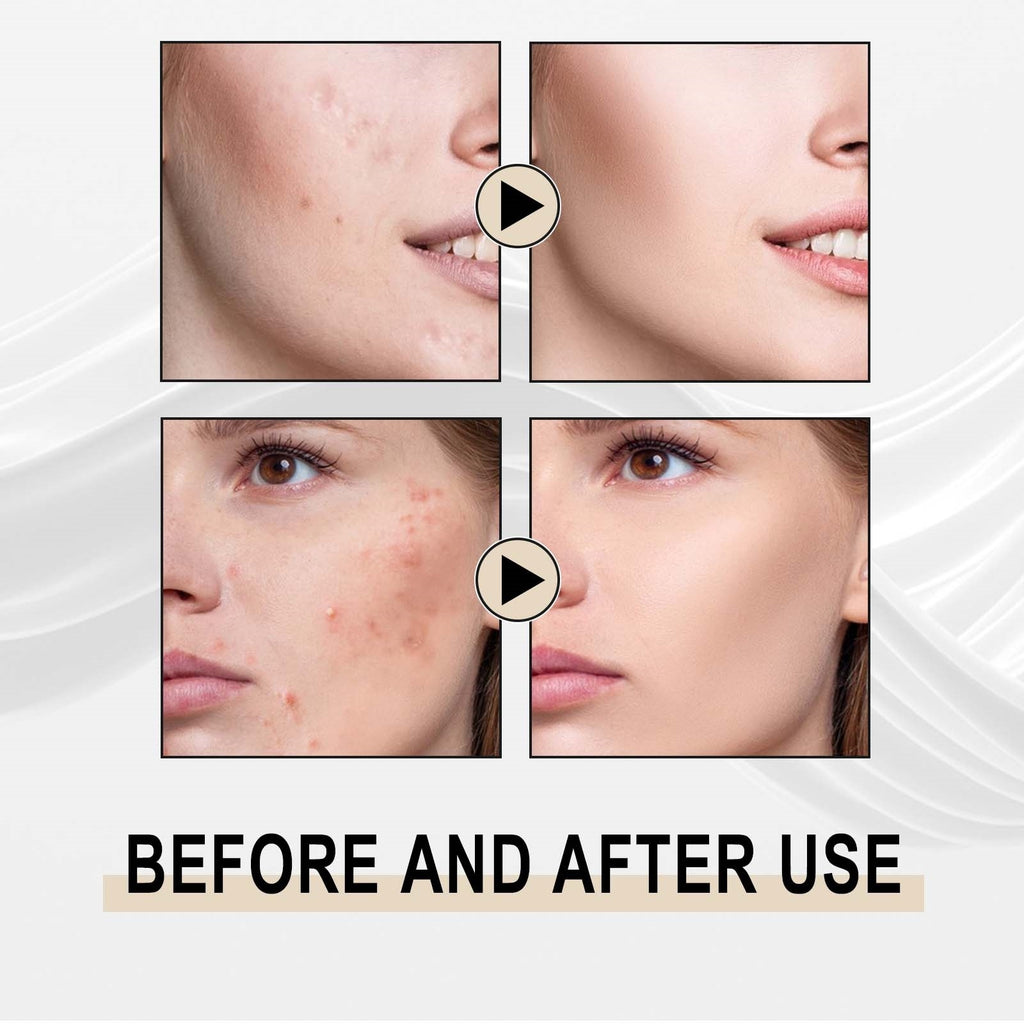 Jaysuing Lactobionic Acid Liquid Exfoliating Blackheads Shrinking Pores Cleansing Moisturizing Skin